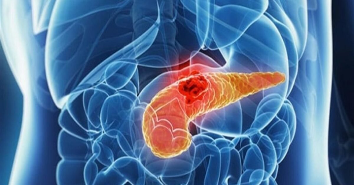 جهاز أبوت للمراقبة المستمرة يدمج قياس الغلوكوز والكيتونات - صورة مميزة صورة مميزة: جهاز أبوت للمراقبة المستمرة يدمج قياس الغلوكوز والكيتونات