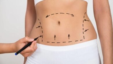 دكتور التجميل علي عبد علي يسلط الضوء على عملية شفط الدهون