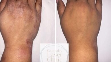 مركز The Carnaby Laser Clinic العيادة التجميلية الطبية الأفضل في الولايات المتحدة UK
