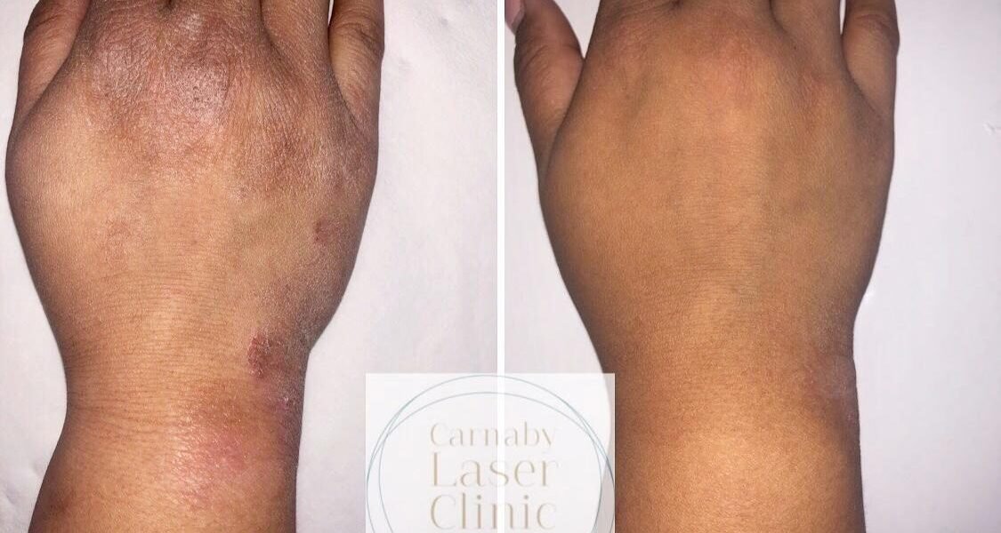 مركز The Carnaby Laser Clinic العيادة التجميلية الطبية الأفضل في الولايات المتحدة UK